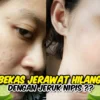 masker jeruk nipis