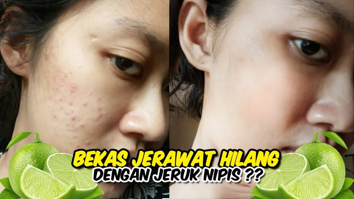 masker jeruk nipis