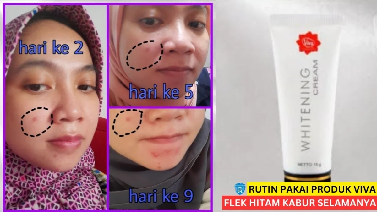 produk viva penghilang flek hitam