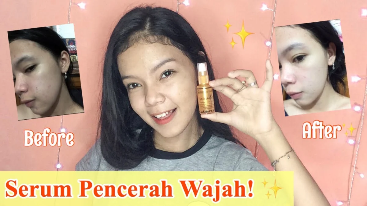 serum Hanasui Gold untuk jerawat