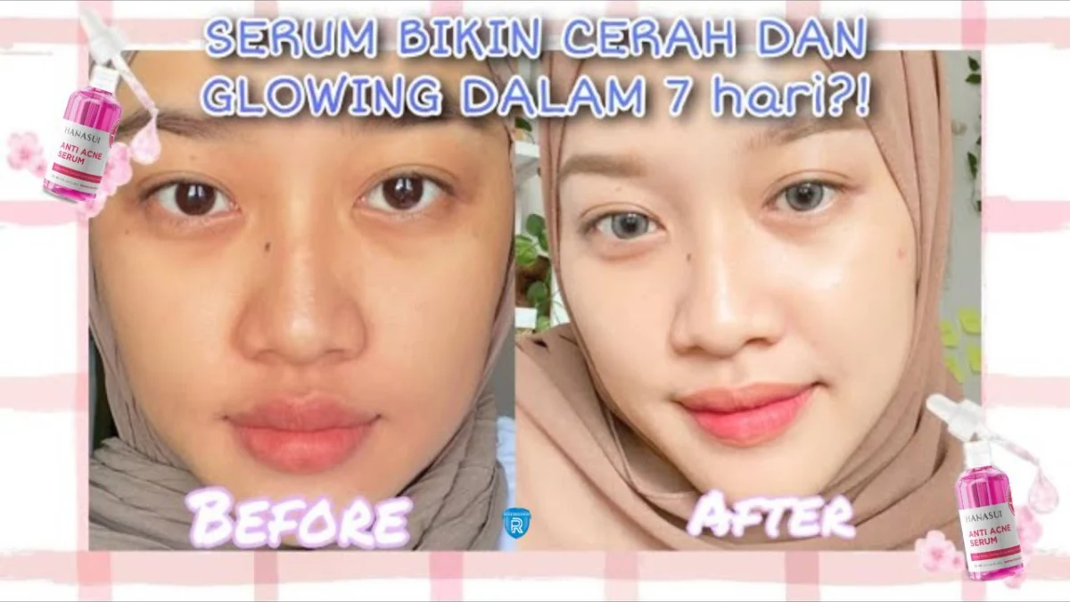 serum hanasui yang bikin glowing