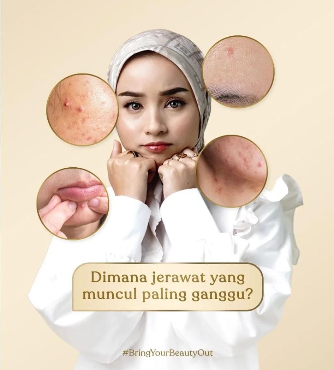 5 Cara Menghilangkan Jerawat Secara Alami dan Cepat, Cuma Pakai Bahan