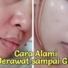 Cara mengatasi jerawat dengan alami dan cepat