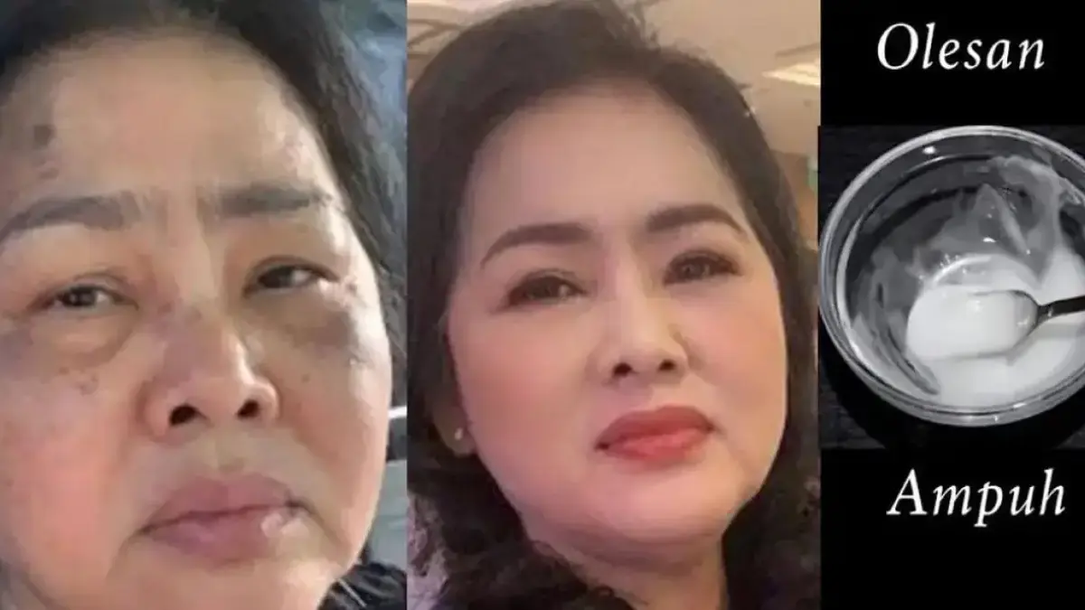 3 Bahan Herbal untuk Mengatasi Penuaan Dini Agar Kencang dan Glowing