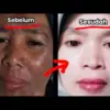 3 Cara Memutihkan Wajah Dengan Jeruk Nipis Dengan Cepat, Ini Tips Aman Menggunakannya!