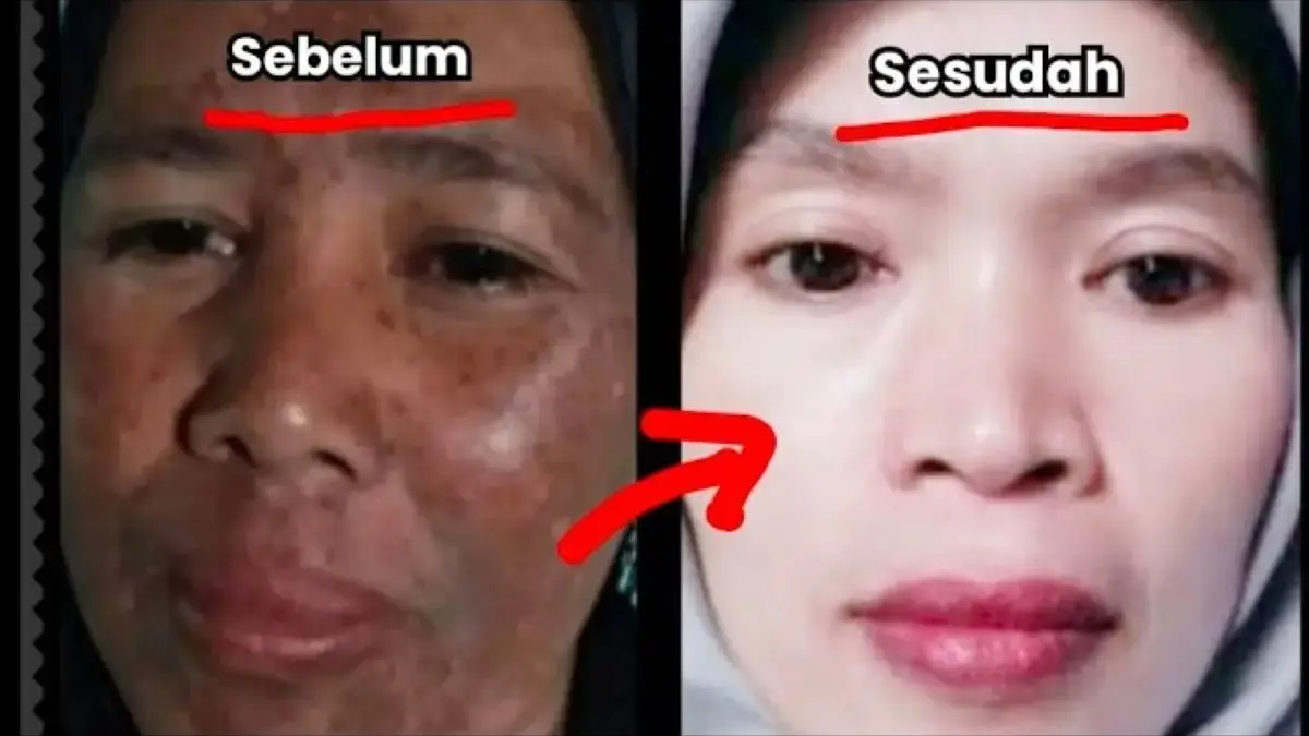 3 Cara Memutihkan Wajah Dengan Jeruk Nipis Dengan Cepat, Ini Tips Aman Menggunakannya!