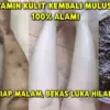 3 Cara Meracik Bahan Dapur untuk Menghilangkan Koreng di Kaki yang Menghitam, Langsung Mulus!
