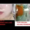 3 Cara Pakai Kunyit untuk Mengelupas Flek Hitam Dalam 1 Malam, Bikin Wajah Glowing 