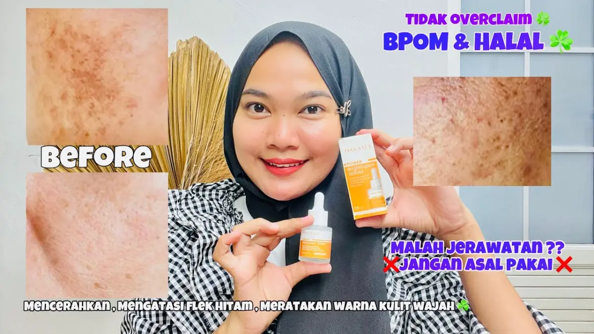 3 Rekomendasi Serum Lokal untuk Menghilangkan Flek Hitam Menahun, Wajah Langsung Glowing!