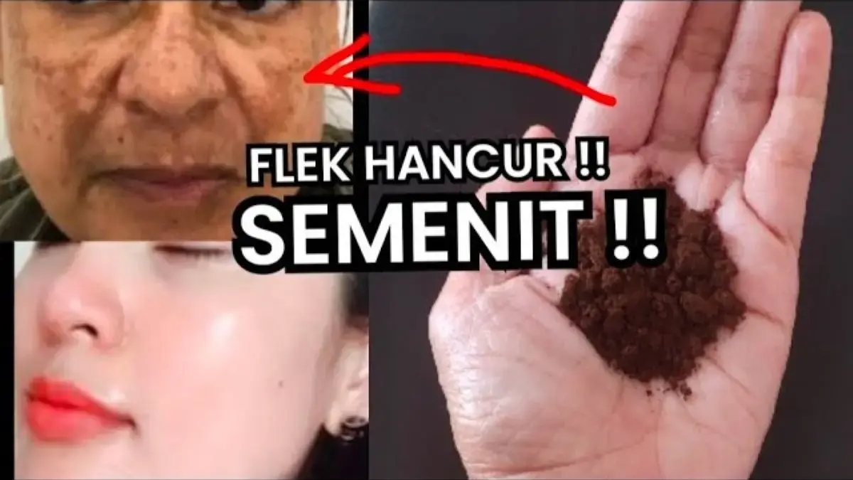 4 Langkah Menghilangkan Flek Hitam Menahun Secara Alami, Cukup 1 Bahan Dapur Kulit jadi Glowing