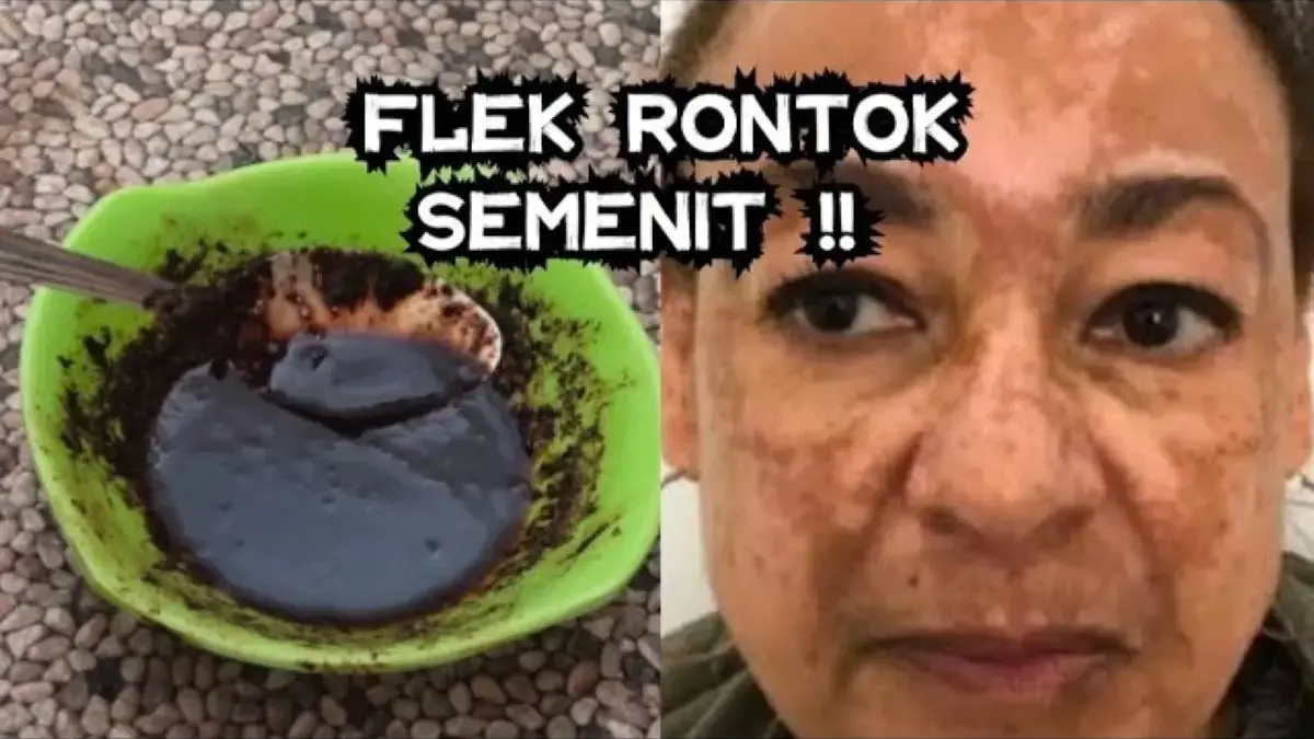 4 Langkah Menghilangkan Flek Hitam di Pipi Secara Alami, Cuma Pakai 1 Bahan Dapur Langsung Glowing