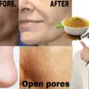 4 Tutorial Mengecilkan Pori-Pori Terbuka Dengan Bahan Dapur, Tambah 1 Bahan Wajah Langsung Mulus