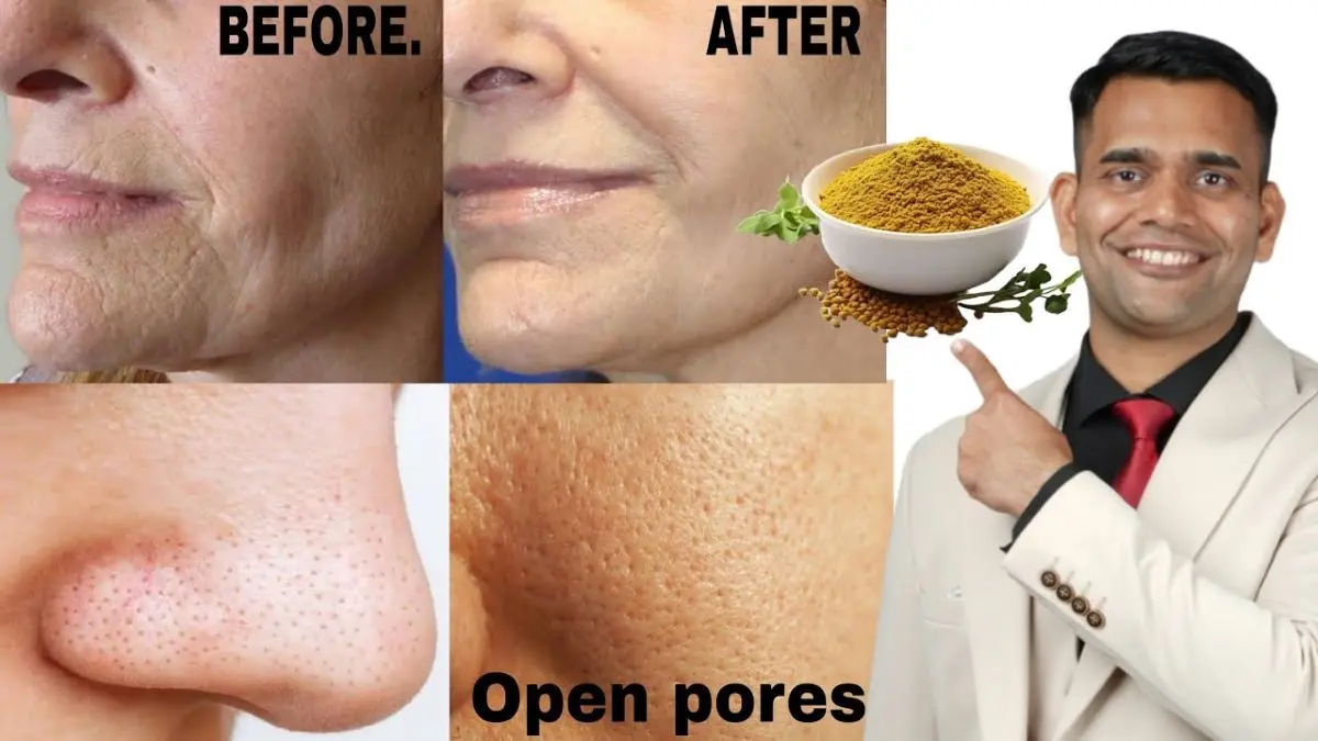 4 Tutorial Mengecilkan Pori-Pori Terbuka Dengan Bahan Dapur, Tambah 1 Bahan Wajah Langsung Mulus