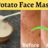 Cara Bikin Masker Kentang untuk Menghilangkan Flek Hitam