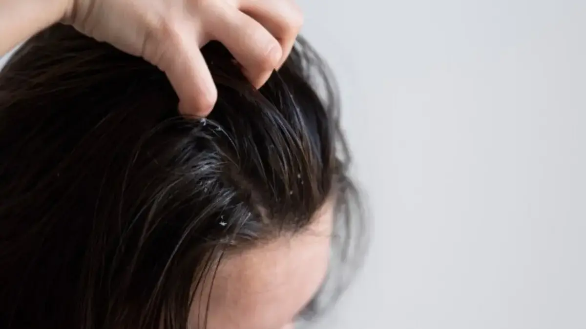 Cara Menguatkan Akar Rambut dengan Masker Temulawak