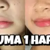 Penyebab Utama Bibir Kering