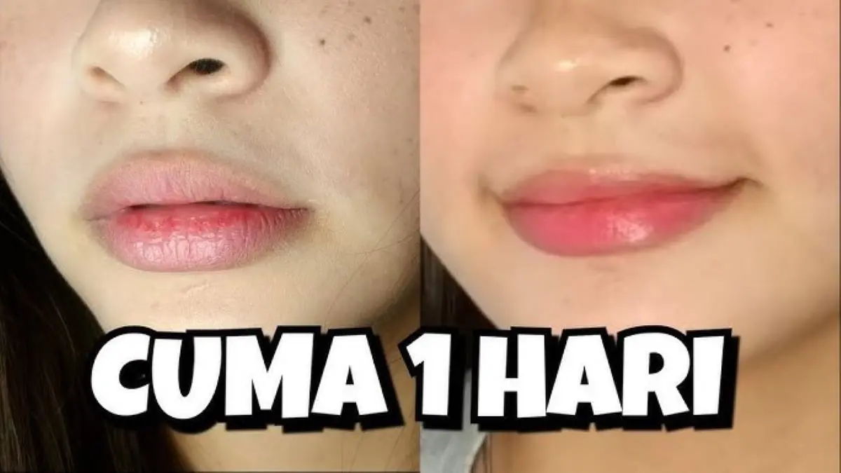 Penyebab Utama Bibir Kering
