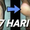 Cara Mengatasi Tumit Pecah-Pecah