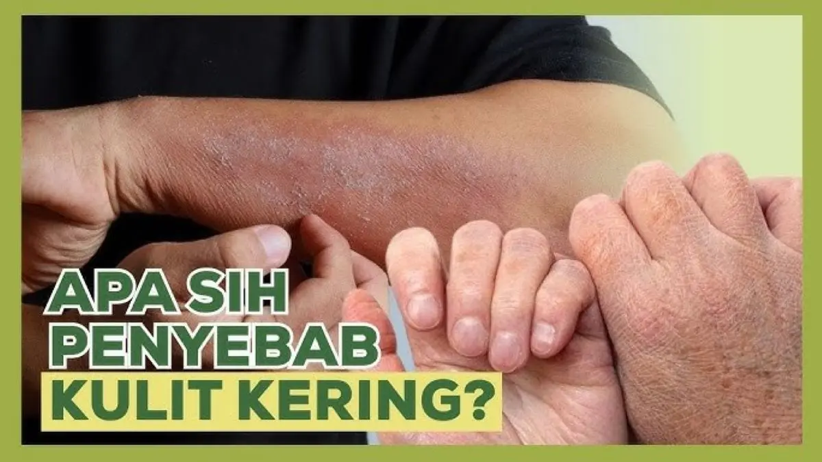 Kebiasaan yang Membuat Kulit Kering