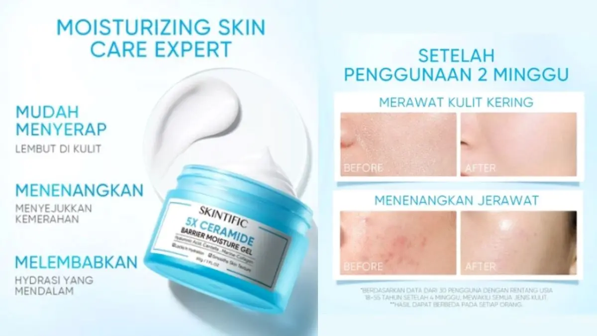 Review Moisturizer Skintific untuk Memperbaiki Skin Barrier