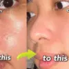 Produk Skincare untuk Mengatasi Komedo