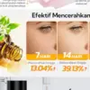 Serum untuk Mencerahkan Kulit yang Cocok Dipakai Sehari-Hari
