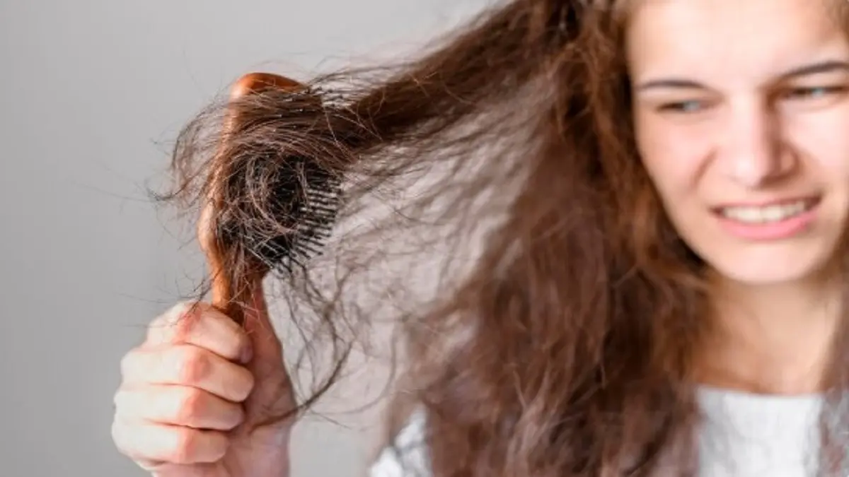 Tanda Tubuh Kekurangan Nutrisi dari Kerusakan Rambut