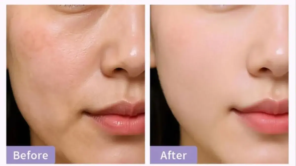 4 Pilihan Skincare Flek Hitam Paling Ampuh yang Bikin Kulit Tampak Lebih Cerah Skincare Flek Hitam Paling Ampuh