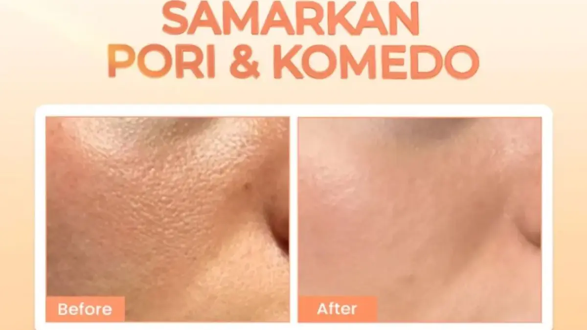 Tips Kecantikan 16 November 2025: Produk Pengecil Pori-Pori yang Bikin Wajah Mulus Tips Kecantikan 16 November 2025