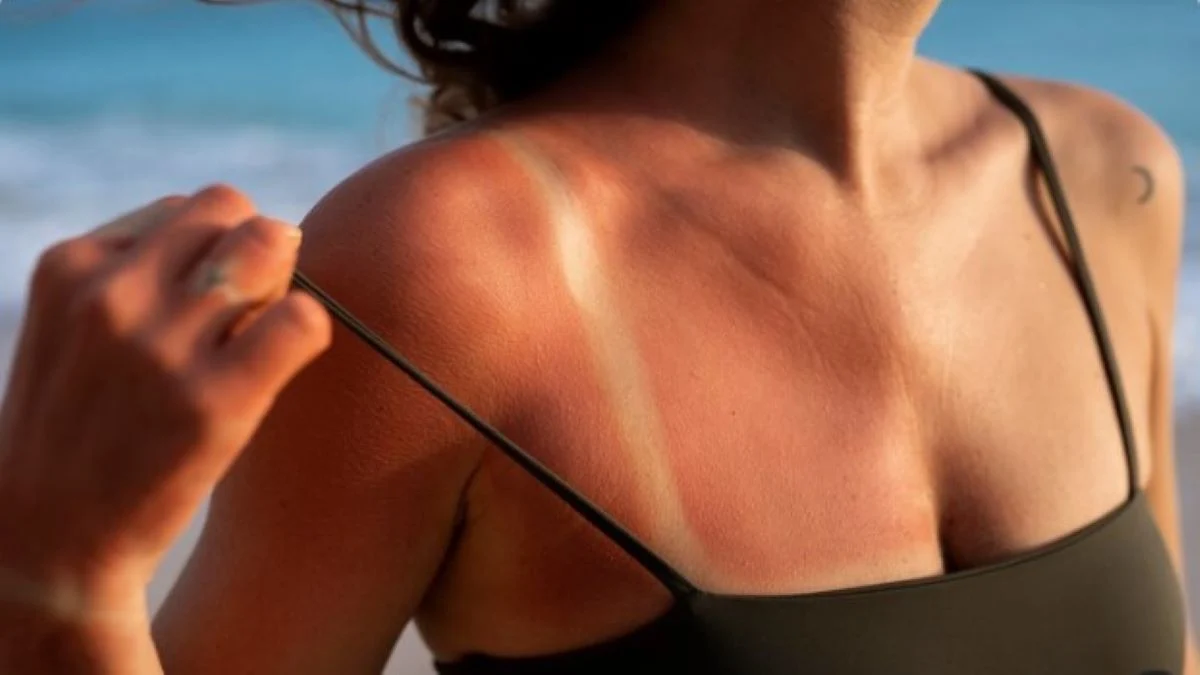 Mengatasi kulit belang dengan body lotion